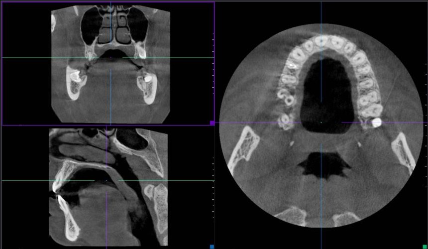 Radiologie Pompidou