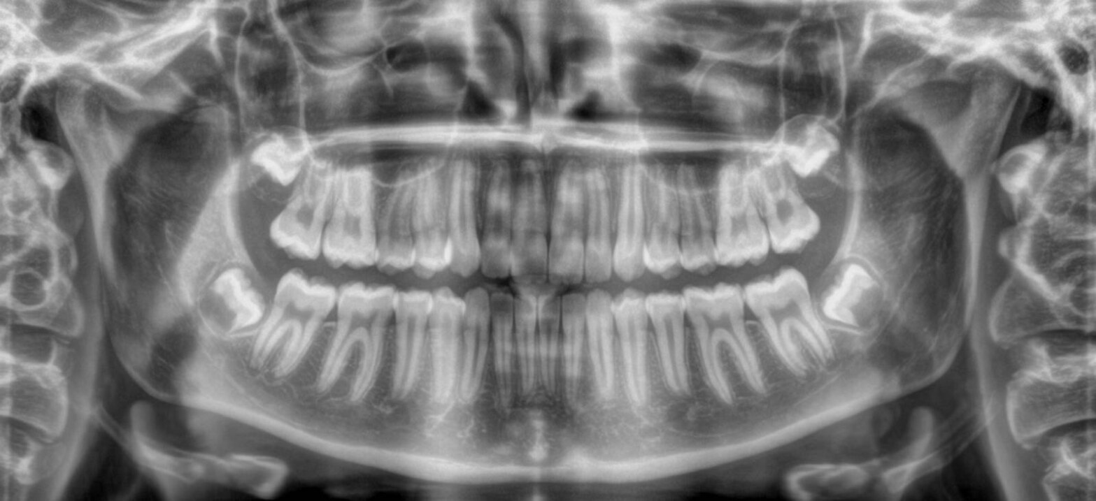 Radiologie dentaire