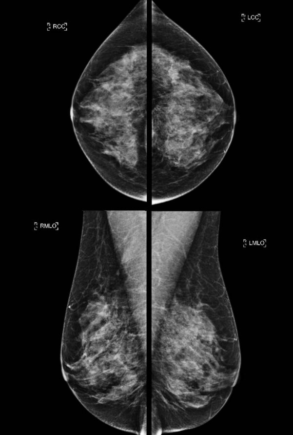 Imagerie de la Femme