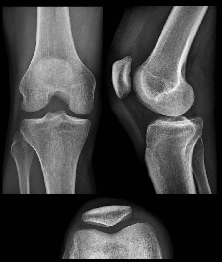 Radiologie générale