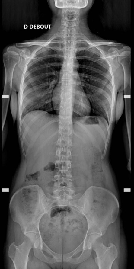Radiologie générale