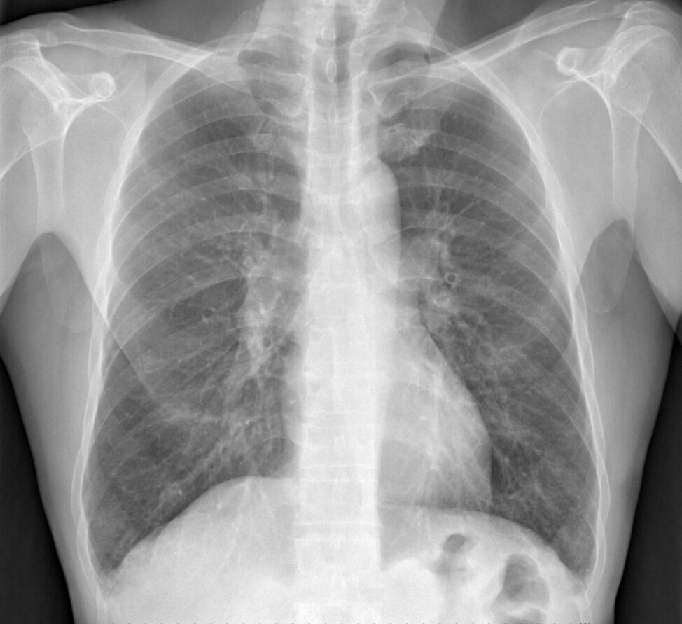 Radiologie générale